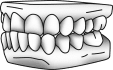 Minor underbite