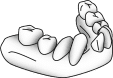 Severely slanted teeth