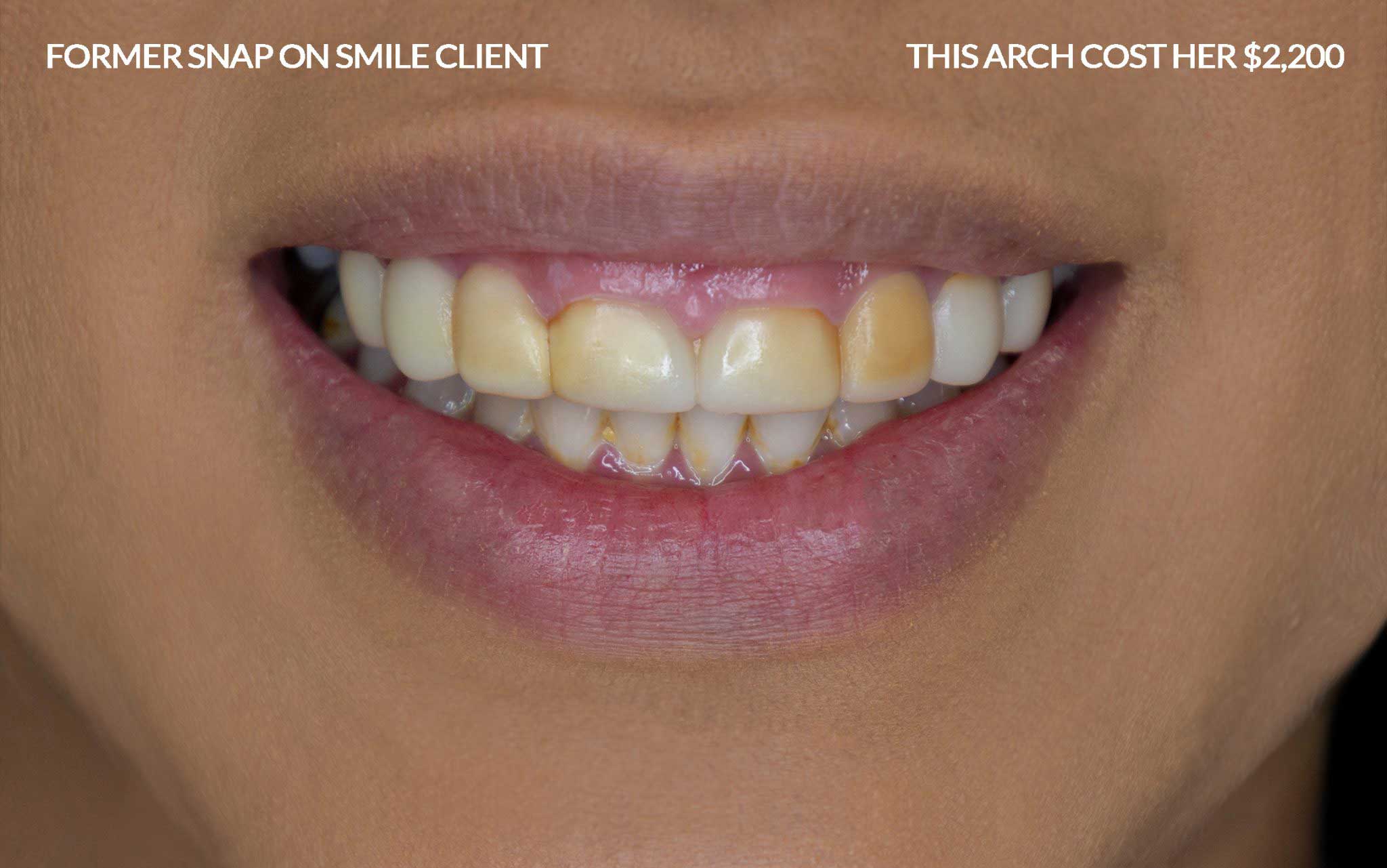 Ana-Snap-On-Smile snap-on-smile-scam