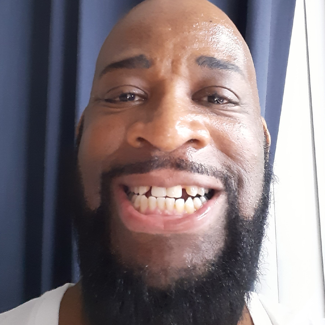 smile transformation smile transformation