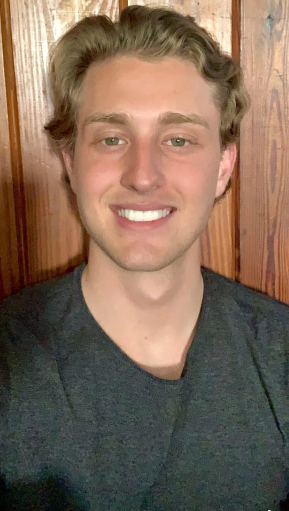 Dustin Myers After Full Face