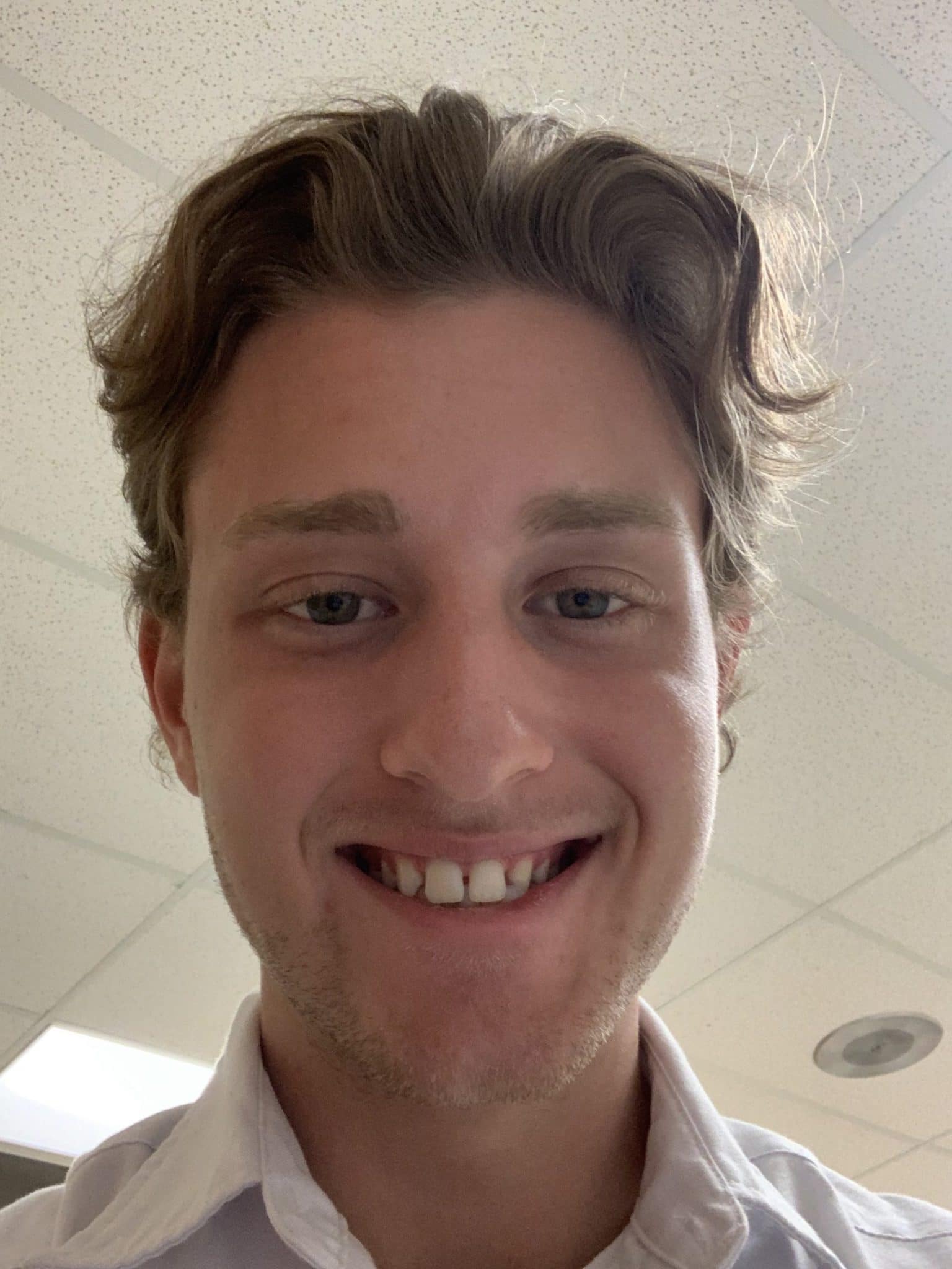 Dustin Myers Before Full Face
