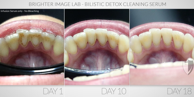Heather_before-after