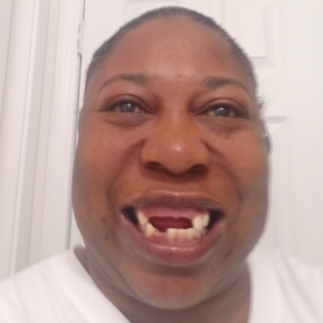smile transformation smile transformation