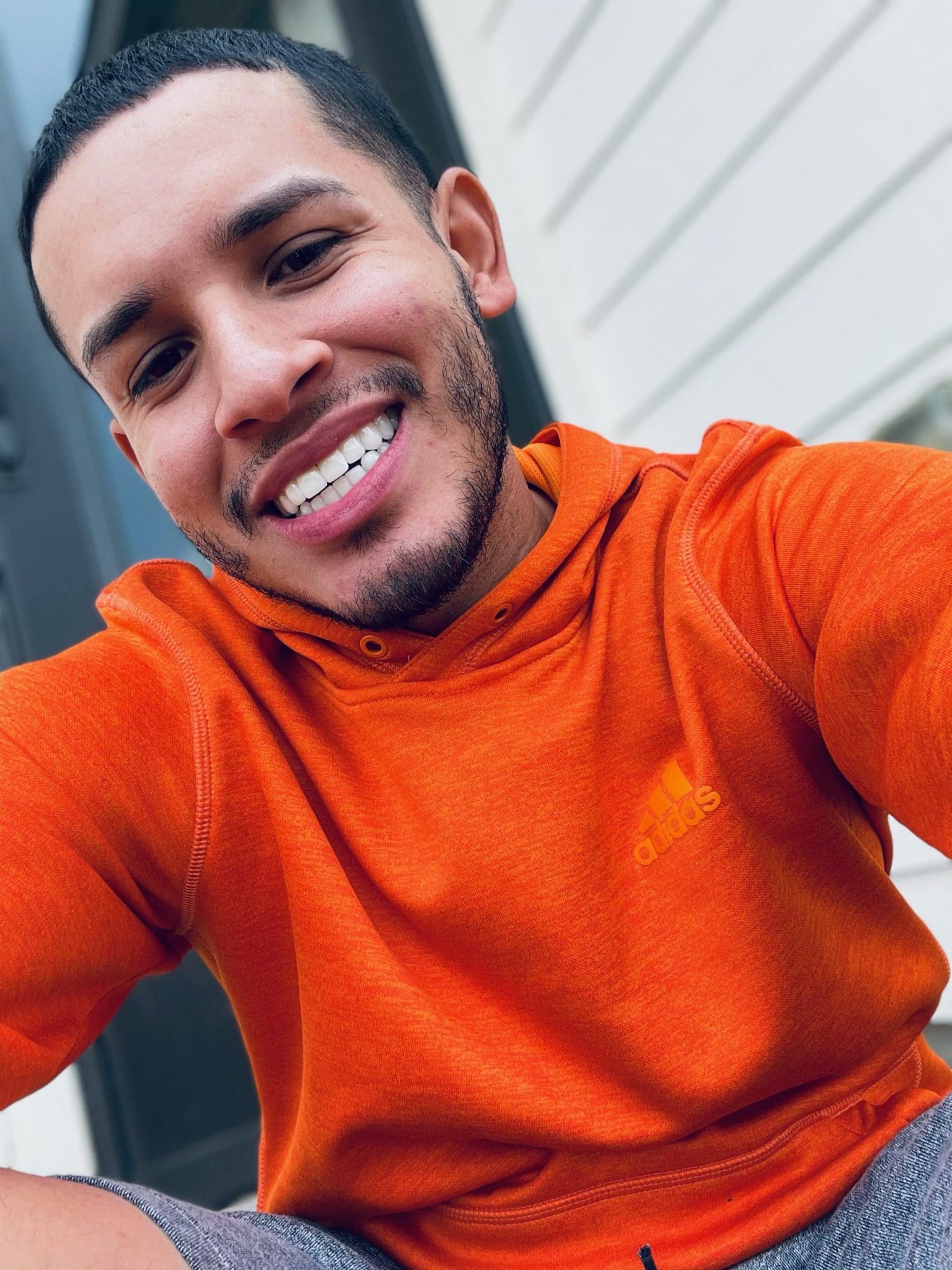 smile transformation smile transformation