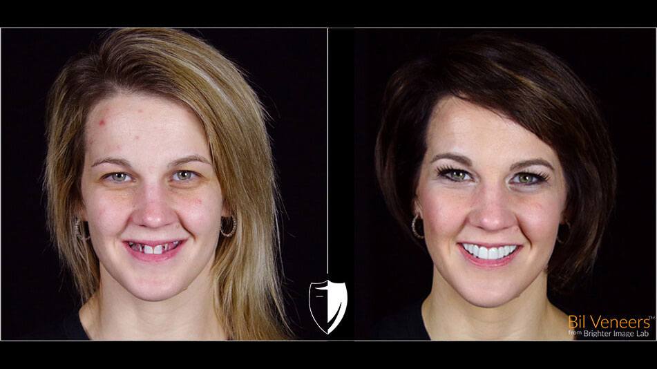 Stacy.jpg smile-makeover
