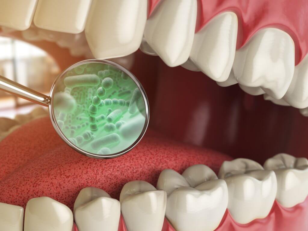 how to remove calculus from teeth without going to the dentist how to remove calculus from teeth without going to the dentist