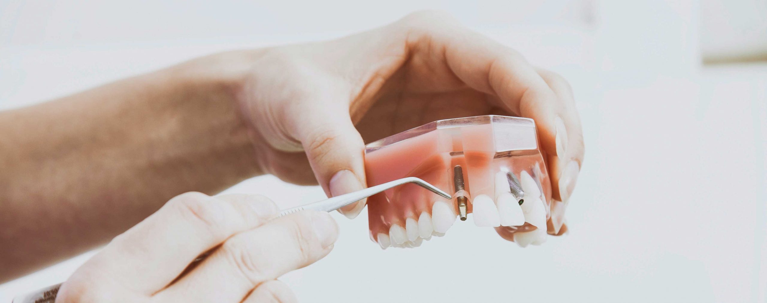 John-C-2020.jpg cosmetic-dentistry-screw