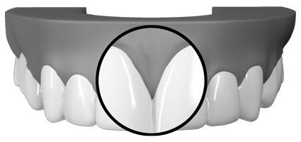 pageant smile