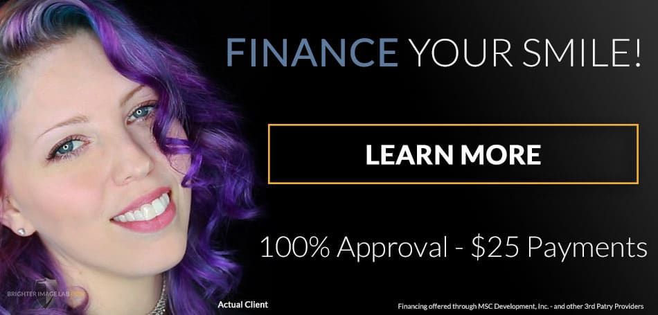 Finance Your Smile - Learn More influencer smile makeover