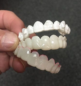 Brighter Image vs Instasmile: Don't fall for cheap clip-on veneers