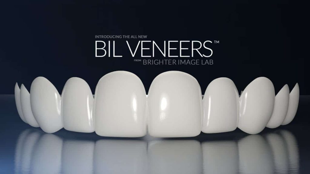 before and after smile makeovers
