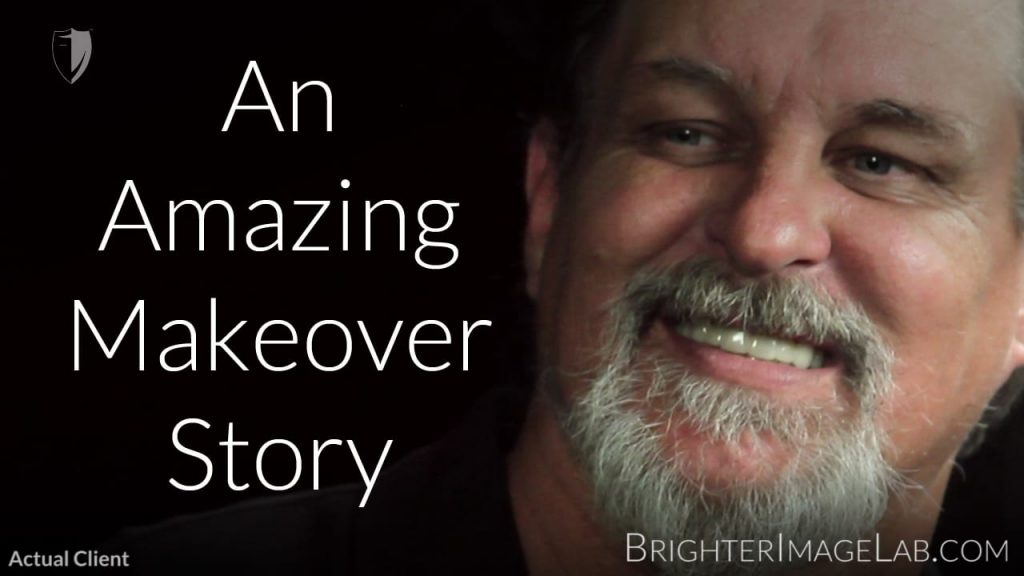 New Life Smile Makeover for 50 Year Old Mechanic