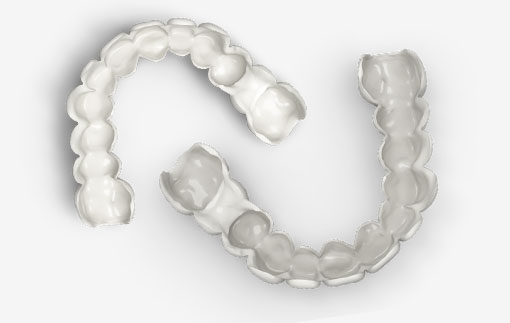 trusmile veneers trusmile veneers