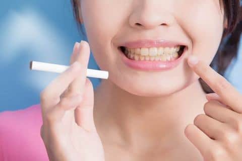 smokers tooth tobacco stains