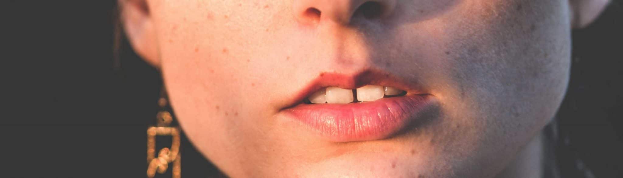 teeth-gap can-a-teeth-gap-be-hidden-by-veneers