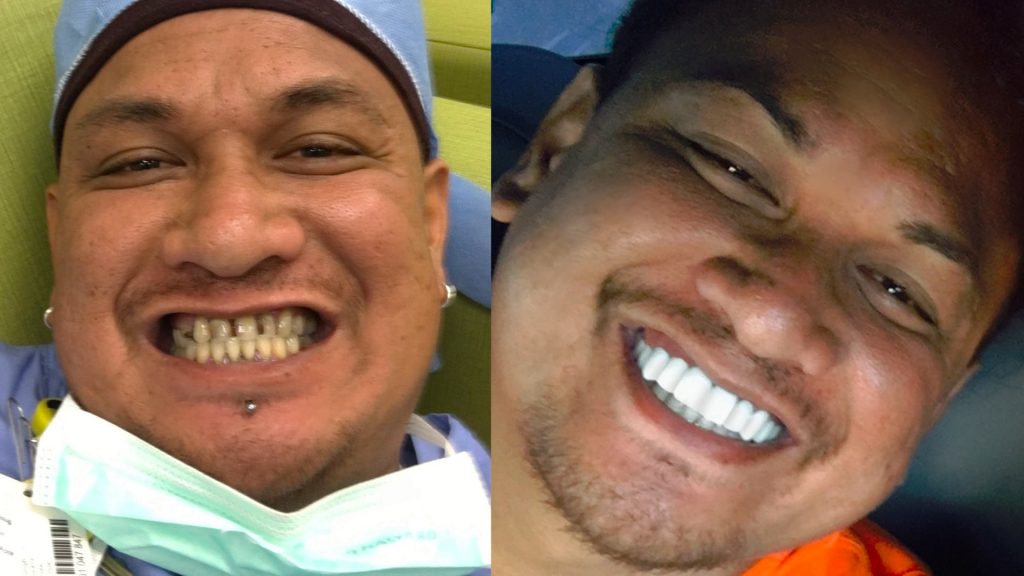 Makeup Artist gets a smile makeover from Brighter Image Lab