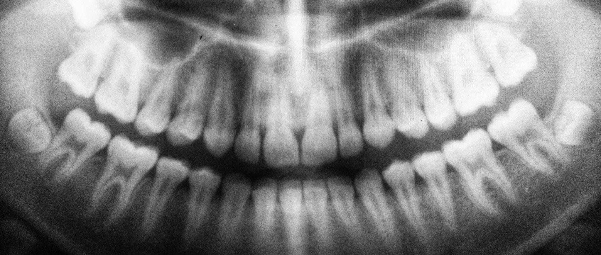 My dentist lied about cavities