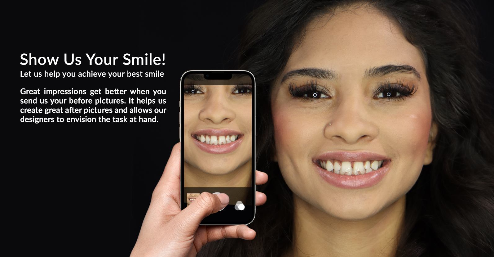 Upload Your Photos to Fix Your Smile at Brighter Image Lab ...