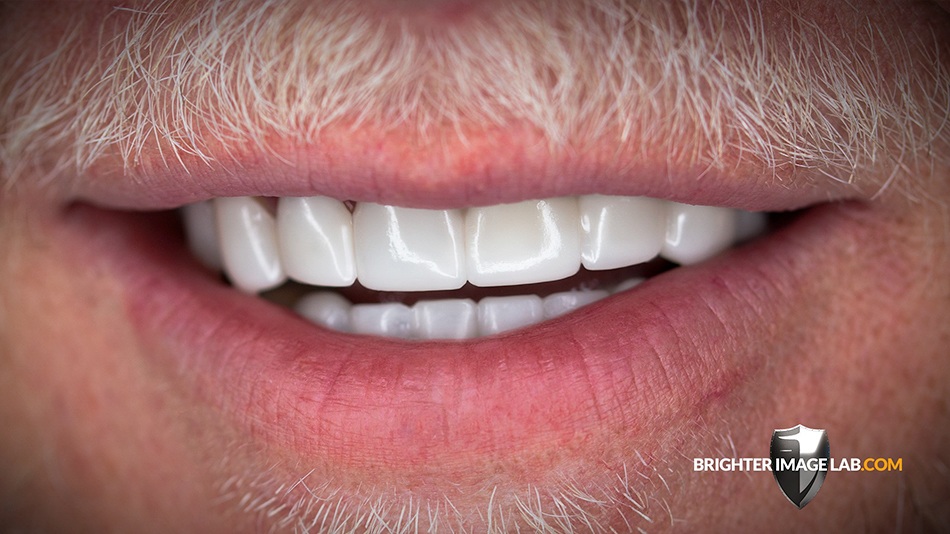 BrentFarrisAfterCloseup-1-1.jpg