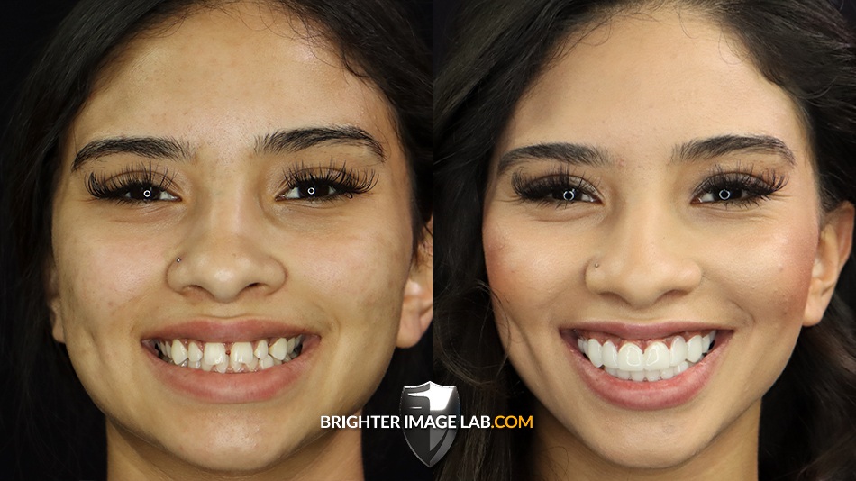MadisenBeforeAfter-1-1.jpg