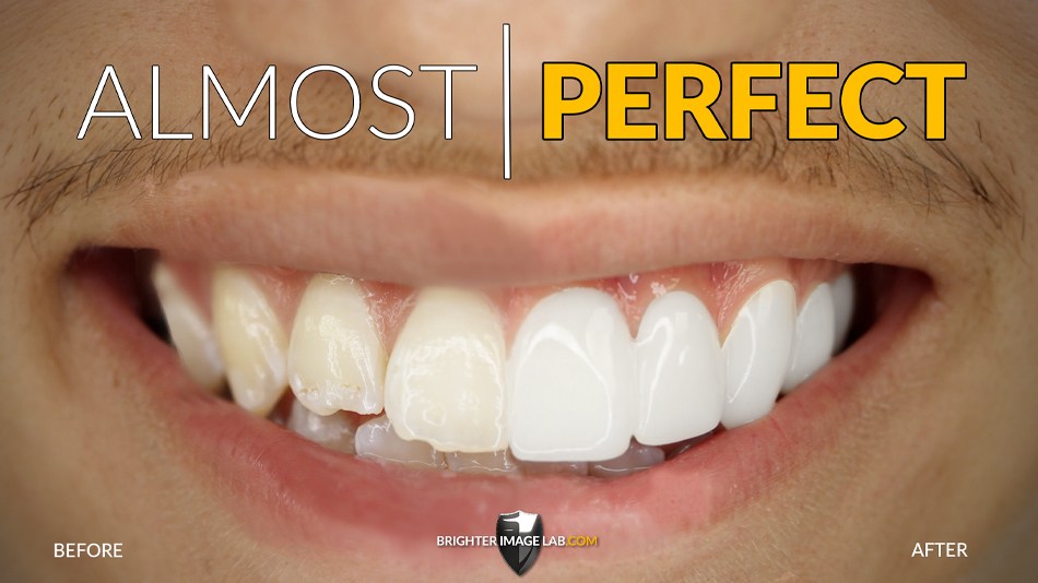 TristanAlmost_Perfect-1-1.jpg
