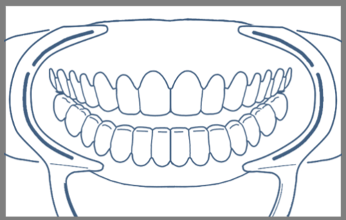 teethshowing